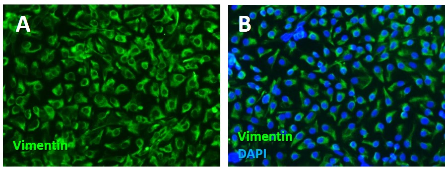 Rat Sertoli Cells_Vemintin